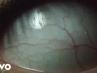 KXLLSWXTCH  RAGE QUIT ft. 1nonly Mp3 Download